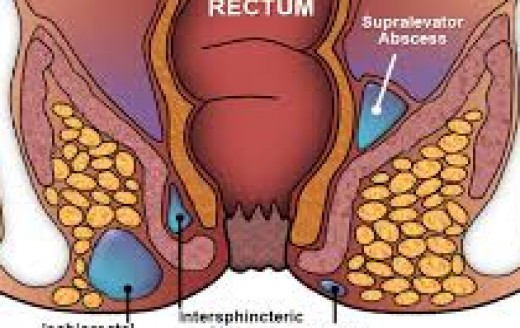 rectum